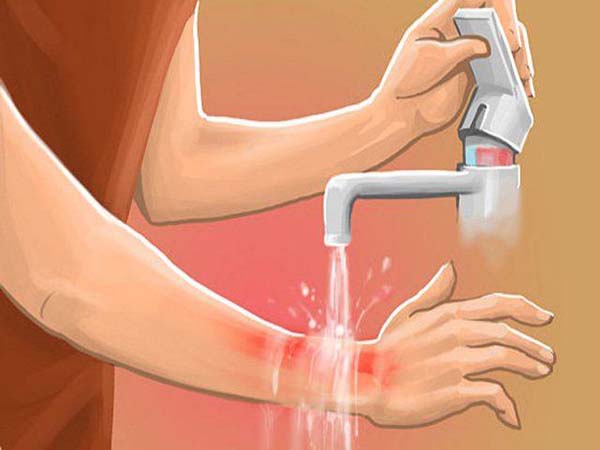 Nằm mơ thấy bị bỏng lửa có ý nghĩa gì?